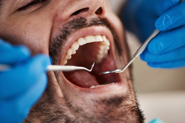 Best Broken Tooth Emergency  in Fort Deposit, AL